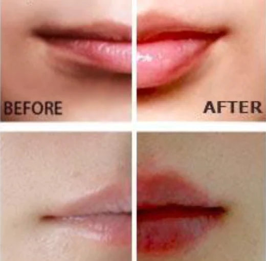 Wunder-Lippenvergrößerer